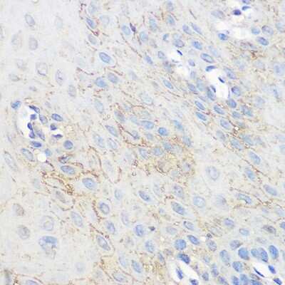 Immunohistochemistry-Paraffin: Adenosine A1R Antibody - Azide and BSA Free [NBP3-15570]