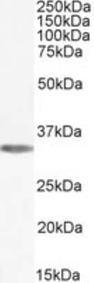 Western Blot: Adenosine A1R Antibody [NBP2-87922]