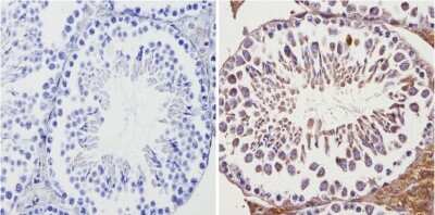 Immunohistochemistry-Paraffin: Adenosine A2aR Antibody [NB300-597]