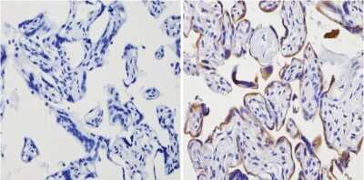 Immunohistochemistry-Paraffin: Adenosine A2aR Antibody [NB300-597]