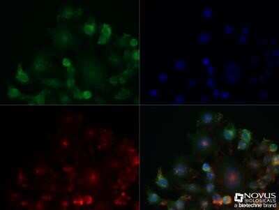 Immunocytochemistry/ Immunofluorescence: Adenosine A2aR Antibody (7F6-G5-A2) - Azide and BSA Free [NBP2-80562]