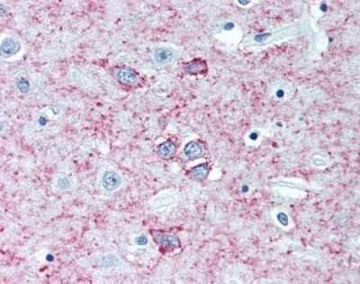 Immunohistochemistry: Adenosine A2aR Antibody (7F6-G5-A2) - Azide and BSA Free [NBP2-80562]