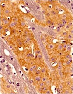 Immunohistochemistry-Paraffin: Adenosine A2aR Antibody (7F6-G5-A2) - Azide and BSA Free [NBP2-80562]