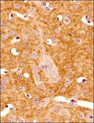 Immunohistochemistry-Paraffin: Adenosine A2aR Antibody (7F6-G5-A2) - Azide and BSA Free [NBP2-80562]