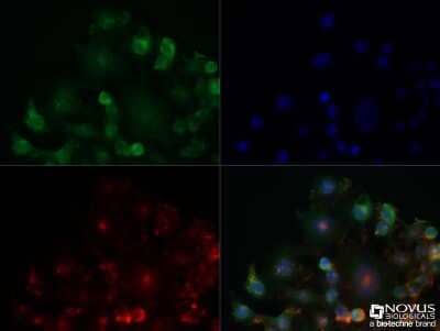 Immunocytochemistry/ Immunofluorescence: Adenosine A2aR Antibody (7F6-G5-A2) - BSA Free [NBP1-39474]