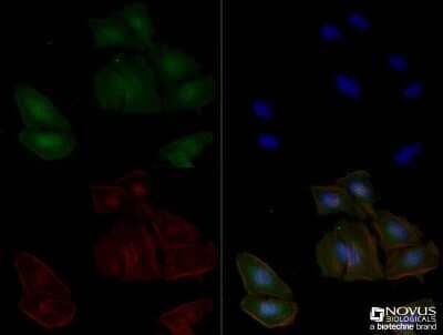 Immunocytochemistry/ Immunofluorescence: Adenosine A2aR Antibody (7F6-G5-A2) - BSA Free [NBP1-39474]