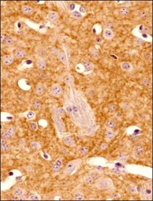 Immunohistochemistry-Paraffin: Adenosine A2aR Antibody (7F6-G5-A2) - BSA Free [NBP1-39474]