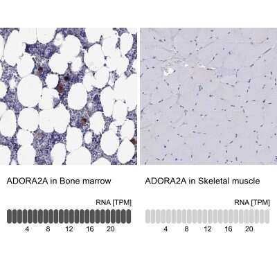 Immunohistochemistry-Paraffin: Adenosine A2aR Antibody [NBP2-62698]