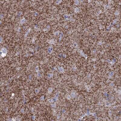 Immunohistochemistry-Paraffin: Adenosine A2aR Antibody [NBP2-62698]