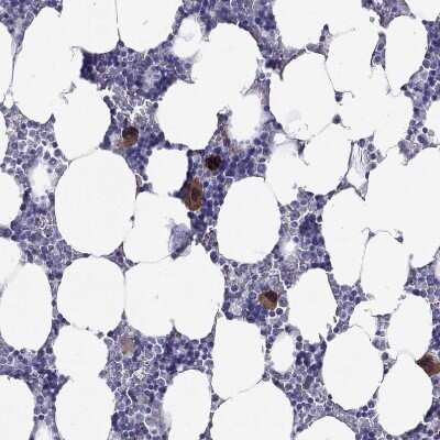 Immunohistochemistry-Paraffin: Adenosine A2aR Antibody [NBP2-62698]