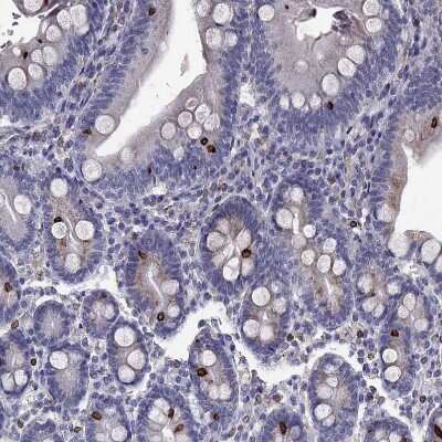 Immunohistochemistry-Paraffin: Adenosine A2aR Antibody [NBP2-62698]
