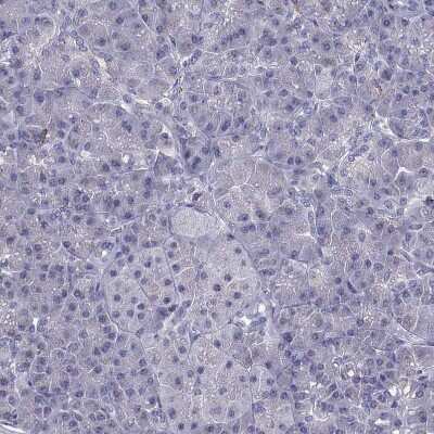 Immunohistochemistry-Paraffin: Adenosine A2aR Antibody [NBP2-62698]
