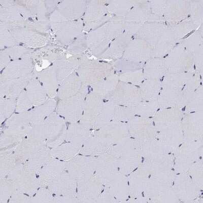 Immunohistochemistry-Paraffin: Adenosine A2aR Antibody [NBP2-62698]