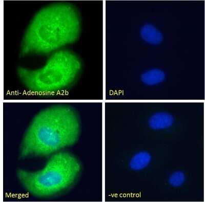 Immunocytochemistry/ Immunofluorescence: Adenosine A2b R Antibody [NB600-797]