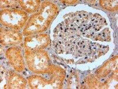 Immunohistochemistry-Paraffin: Adenosine A2b R Antibody [NB600-797]