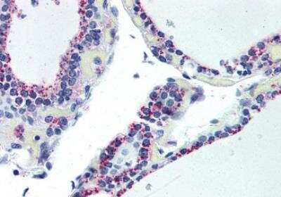 Immunohistochemistry-Paraffin: Adenosine A2b R Antibody - BSA Free [NBP1-44332]