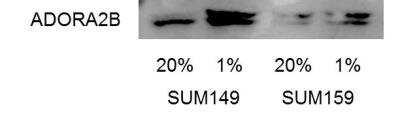 Western Blot: Adenosine A2b R Antibody [NBP1-68953]