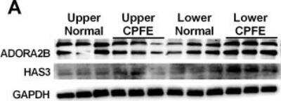 Western Blot: Adenosine A2b R AntibodyBSA Free [NBP2-41312]