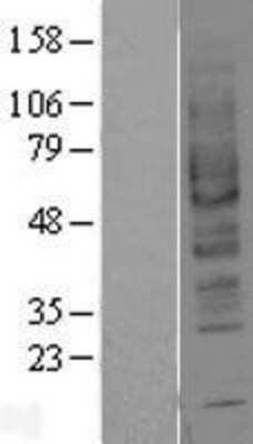 Western Blot: Adenosine A2b R Overexpression Lysate [NBL1-07351]