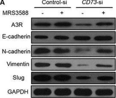 Western Blot: Adenosine A3 R Antibody [NLS689]