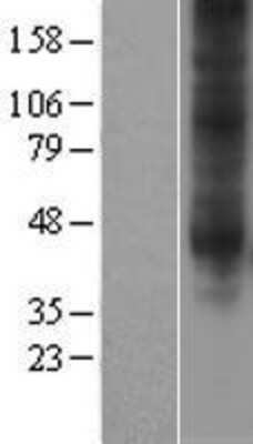 Western Blot: Adenosine A3 R Overexpression Lysate [NBP2-04172]