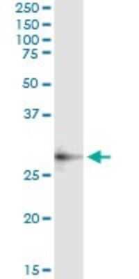 Immunoprecipitation: Adenosine Deaminase 2/CECR1 Antibody (3D11) [H00051816-M01]