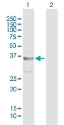 Western Blot: Adenosine Deaminase 2/CECR1 Antibody [H00051816-B01P]