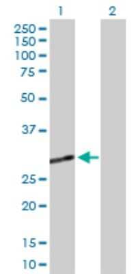 Western Blot: Adenosine Deaminase 2/CECR1 Antibody [H00051816-D01P]