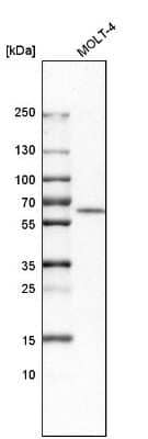 Western Blot: Adenosine Deaminase 2/CECR1 Antibody [NBP1-89238]