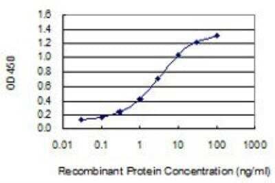 ELISA: Adenosine Deaminase/ADA Antibody (4G4-1C6) [H00000100-M01]
