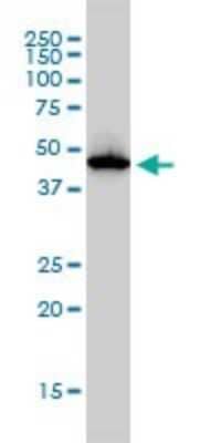 Western Blot: Adenosine Deaminase/ADA Antibody (4G4-1C6) [H00000100-M01]