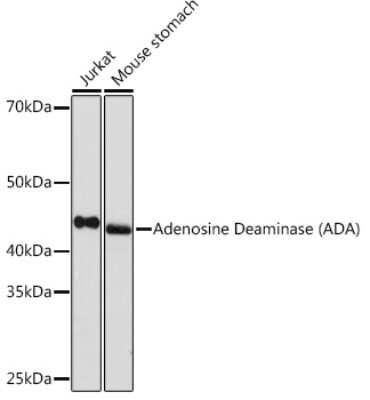 Western Blot: Adenosine Deaminase/ADA Antibody (5R10B4) [NBP3-16575]