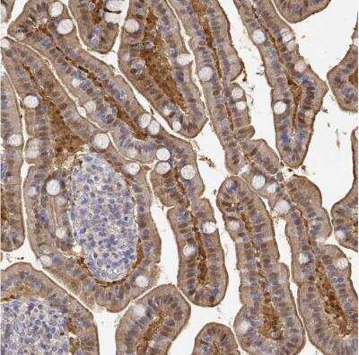 Immunohistochemistry-Paraffin: Adenosine Deaminase/ADA Antibody [NBP1-87404]