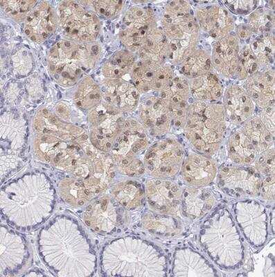Immunohistochemistry-Paraffin: Adenosine Deaminase/ADA Antibody [NBP1-87404]