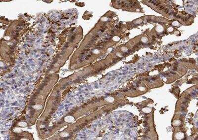 Immunohistochemistry-Paraffin: Adenosine Deaminase/ADA Antibody [NBP1-87404]