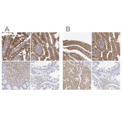 Immunohistochemistry-Paraffin: Adenosine Deaminase/ADA Antibody [NBP1-87404]