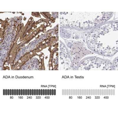 Immunohistochemistry-Paraffin: Adenosine Deaminase/ADA Antibody [NBP1-87404]