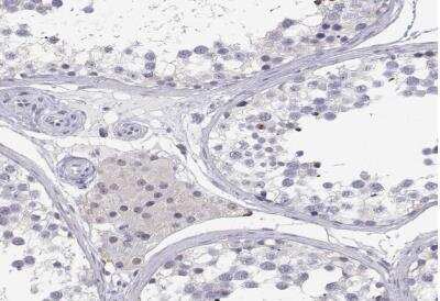 Immunohistochemistry-Paraffin: Adenosine Deaminase/ADA Antibody [NBP1-87404]