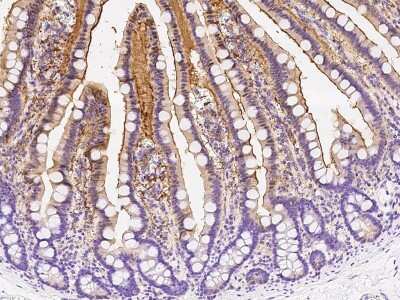 Immunohistochemistry-Paraffin: Adenosine Deaminase/ADA Antibody [NBP2-98772]