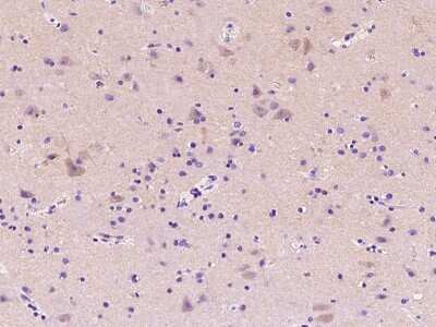 Immunohistochemistry-Paraffin: Adenosine Deaminase/ADA Antibody [NBP2-98772]