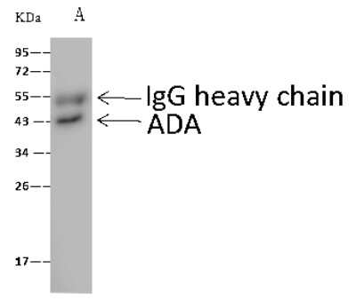 Immunoprecipitation: Adenosine Deaminase/ADA Antibody [NBP2-98772]
