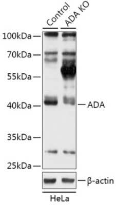 Knockout Validated: Adenosine Deaminase/ADA Antibody - Azide and BSA Free [NBP3-03469]