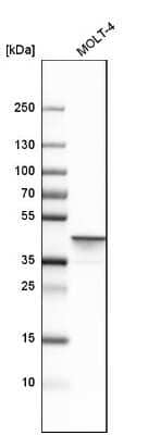 Western Blot: Adenosine Deaminase/ADA Antibody [NBP1-87404]