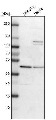 Western Blot: Adenosine Deaminase/ADA Antibody [NBP1-87404]
