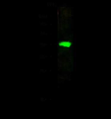 Western Blot: Adenosine Deaminase/ADA Antibody [NBP2-98771]