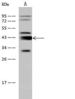 Western Blot: Adenosine Deaminase/ADA Antibody [NBP2-98772]