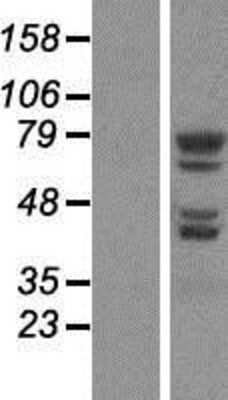 Western Blot: ADK Overexpression Lysate [NBP2-10955]