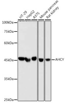 Western Blot: Adenosylhomocysteinase/AHCY Antibody (4E9H10) [NBP3-16147]