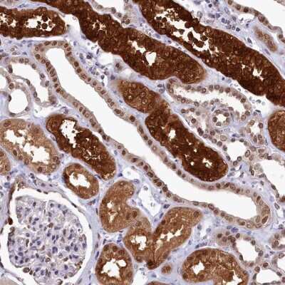 Immunohistochemistry: Adenosylhomocysteinase/AHCY Antibody [NBP2-48731]