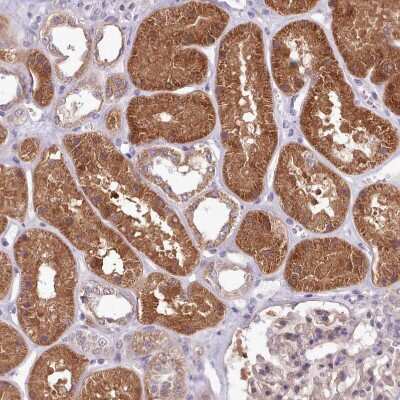 Immunohistochemistry-Paraffin: Adenosylhomocysteinase/AHCY Antibody [NBP2-48817]